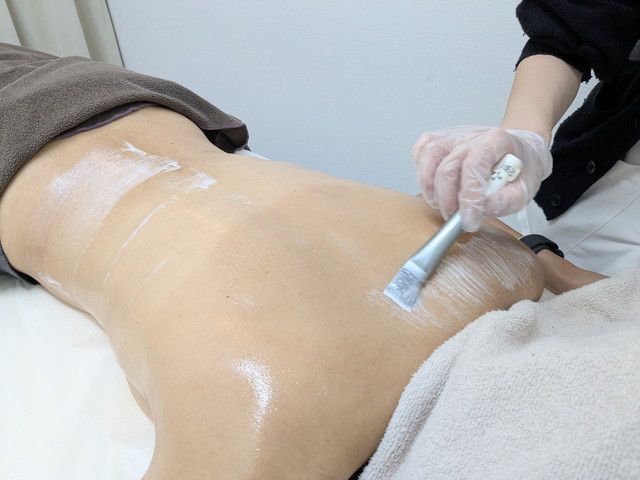 専用ブラシで薬剤を背中全体に広げている施術の様子