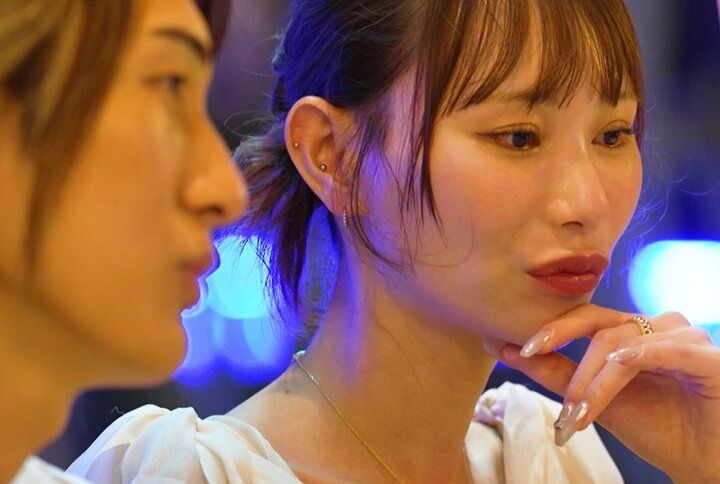 【写真・画像】「今後も整形し続けるのか？」“整形総額1000万円”の28歳美女、無整形イケメンからの質問に本音で回答 1枚目