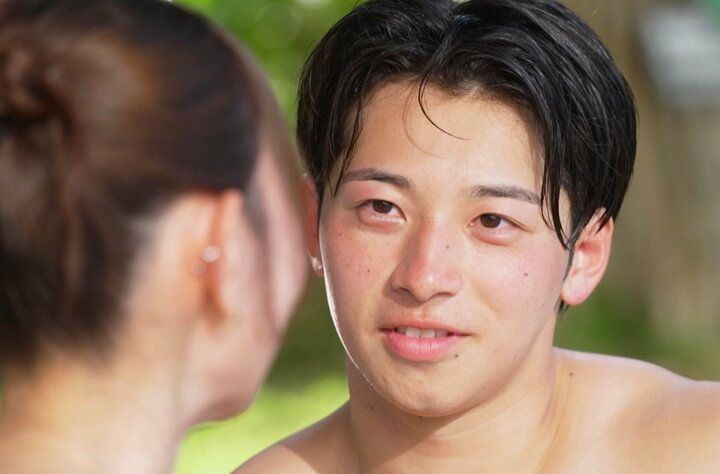 【写真・画像】「整形総額1000万円」28歳美容クリニック社員、整形前の写真を公開「めっちゃ綺麗じゃん」無整形イケメンが驚き 2枚目