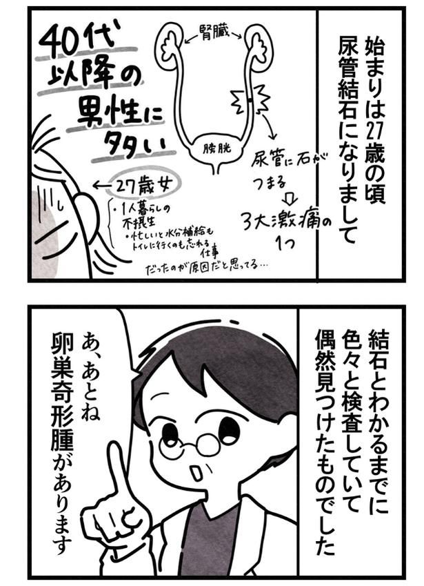 27歳で尿管結石になった女性『卵巣嚢腫手術レポ』03 画像提供：まえだ永吉さん