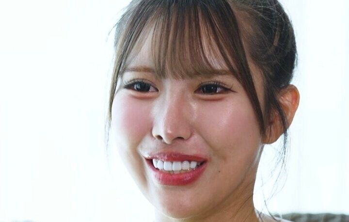 【写真・画像】 「整形総額800万円」デリケートゾーン整形もした25歳キャバ嬢に「整形代はどうしたの？」無整形イケメンが資金源について質問 1枚目