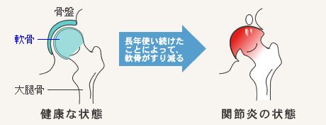 大人のおしゃれ手帖 股関節