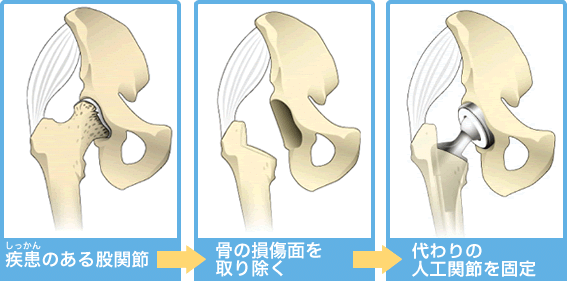 大人のおしゃれ手帖 股関節