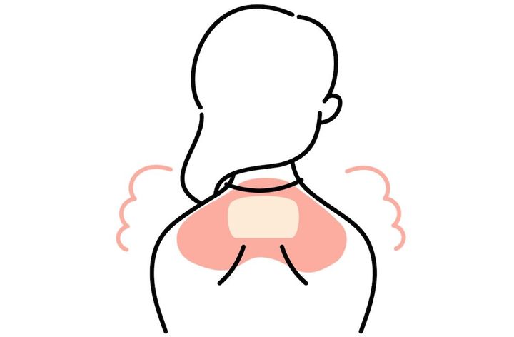 首の後ろをカイロなどで温める女性のイラスト