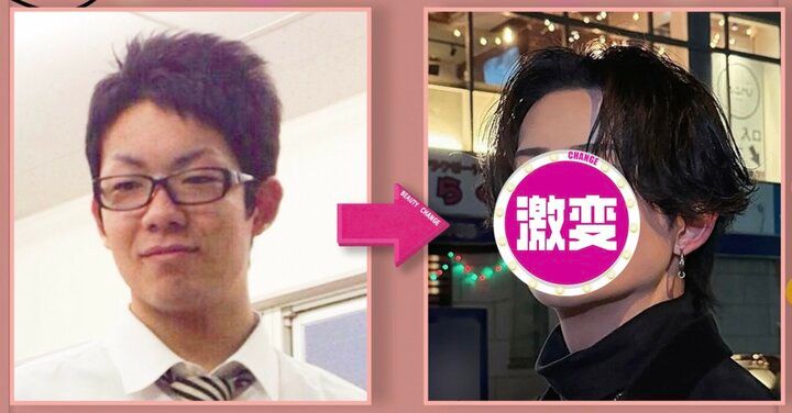 【写真・画像】大学時代に彼女に浮気され…整形総額500万円で亀梨和也似に激変したイケメン、ビフォーアフターに驚きの声「全然違う！」「いわゆる整形顔じゃない！」 1枚目
