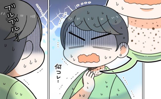 イボ イメージカット