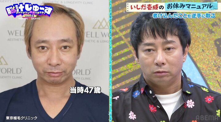 【写真・画像】いしだ壱成「ハゲてきた」当時の写真を公開 2枚目