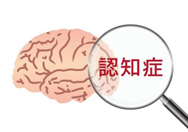 加齢とともに増加！脳の最大の敵「アミロイドβ」
