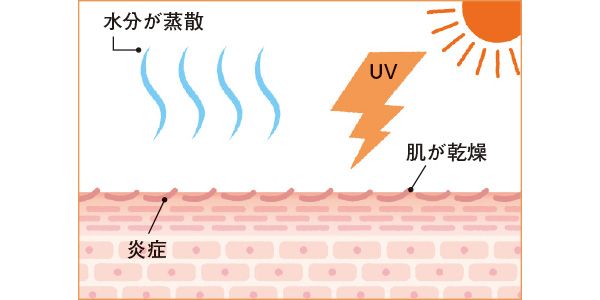 水分が蒸散 UV 肌が乾燥 炎症