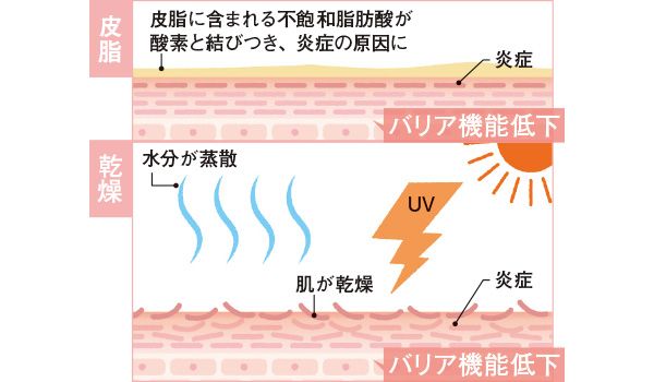 【皮脂】皮脂に含まれる不飽和脂肪酸が酸素と結びつき、炎症の原因に 炎症 バリア機能低下 【乾燥】水分が蒸散 UV 肌が乾燥 炎症 バリア機能低下