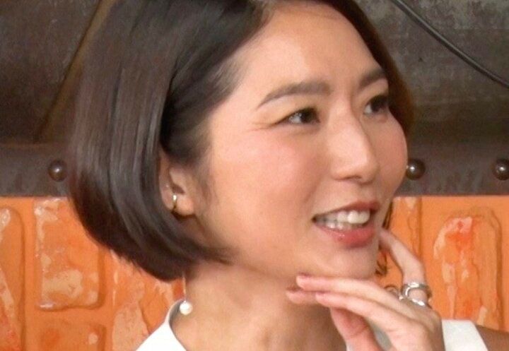 【写真・画像】松島聡似のイケメン歯科医（36）、1回8万円の肌メンテナンス・ビフォーアフターを公開「肌を赤ちゃんに戻す」 1枚目