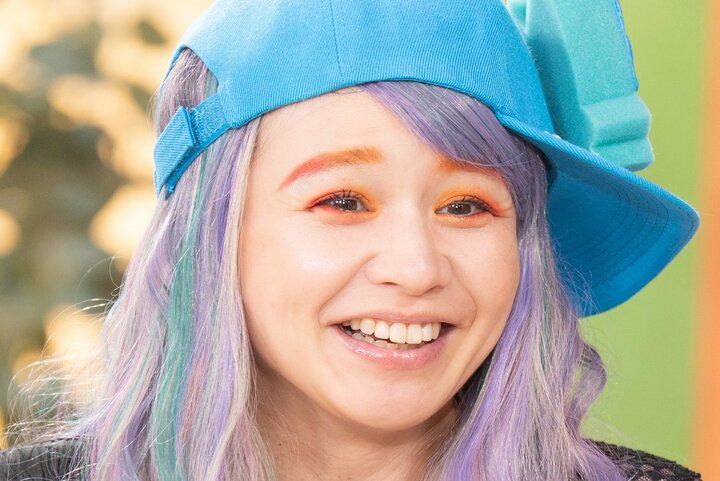 【写真・画像】「ノー整形、ノー枕営業でやらせてもらってます」平成を代表する歌姫（41）、整形願望を告白 1枚目