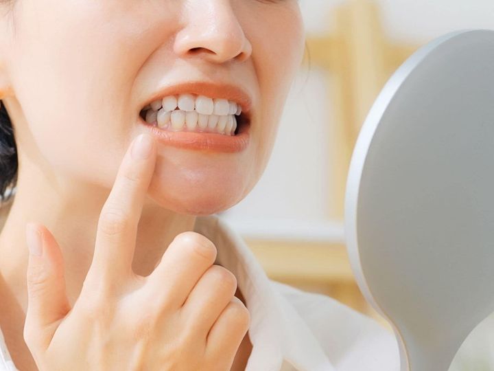 【医師が回答】「口内炎くらい放っておけば自然に治る」と思っていませんか？ 長過ぎる様子見は命にかかわる危険もあり、注意が必要です。2週間以上治らない口内炎に潜むリスクについて、解説します。（※画像：Shutterstock.com）