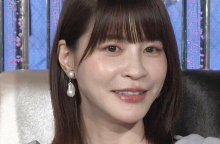 【写真・画像】「1週間前に糸リフトをしました」ざわちん、今後の整形計画を明かす「大きな手術をするかは…」 1枚目