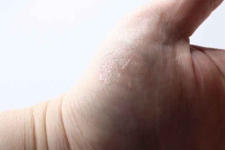 手の甲に塗られた透明で細かいラメ入りのリッププランパー