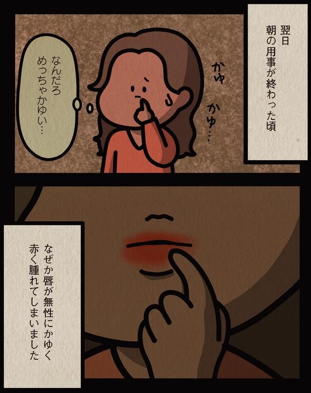 唇が無性にかゆく （C）しばたま/KADOKAWA