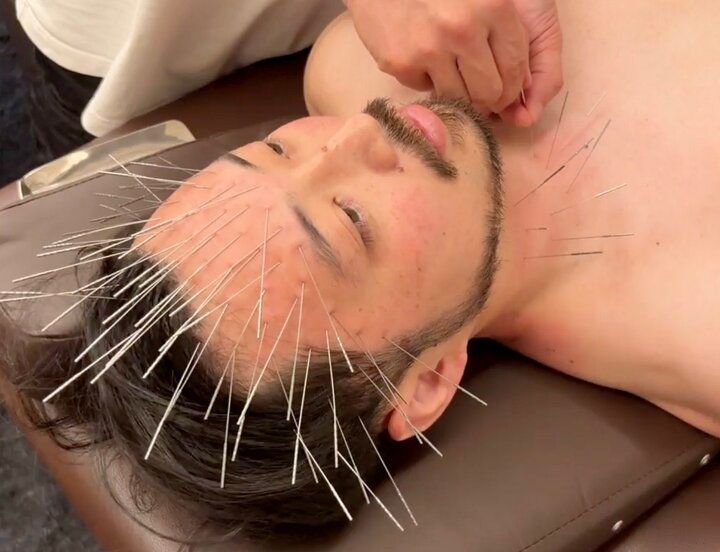 流行りのルート治療