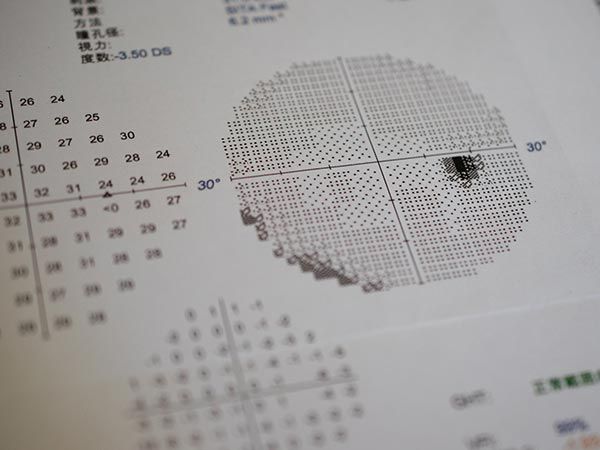 緑内障の治療を開始！専門医を探す際のポイント
