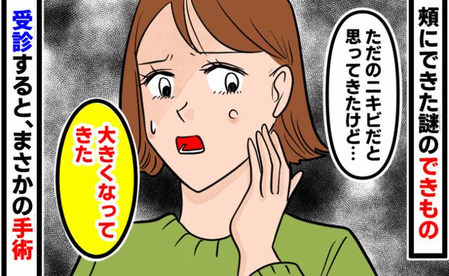 粉瘤 イメージカット