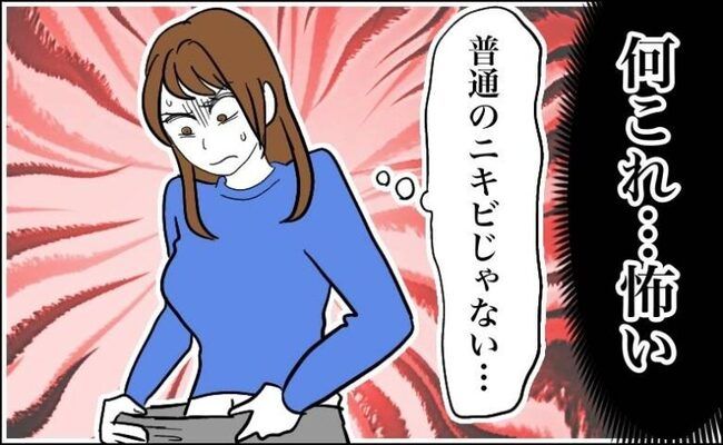 粉瘤 イメージカット