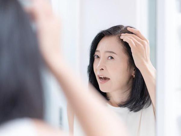 NG習慣（4）「フケ・かゆみ」が止まらない！悪化させる食生活