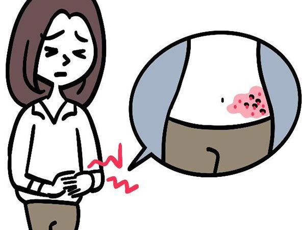 NG習慣（1）ちょっと痛いだけかも？ と様子見…「帯状疱疹」