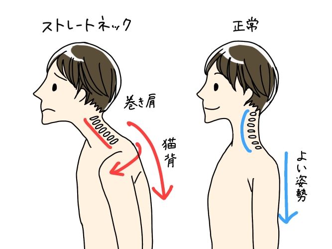 ガチガチの首こりが軽くなるストレッチ7選｜1回で実感＆1日3分でスッと回る | トレーニング ×スポーツ『MELOS』