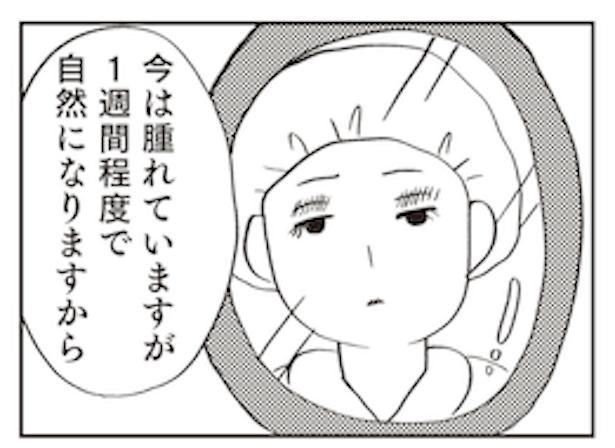 「親に整形させられた私が母になる エリカの場合」2 画像提供：(C)グラハム子