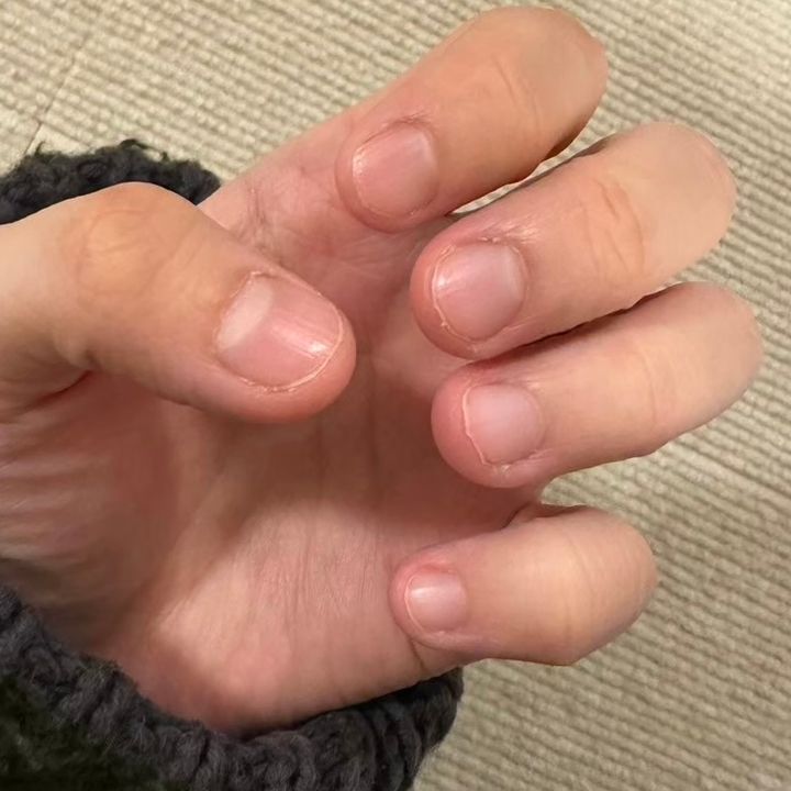 1年以上向き合った、爪のコンプレックスの話【FUDGENA SPECIALIST：kinokoのボーイズスタイル vol.174】