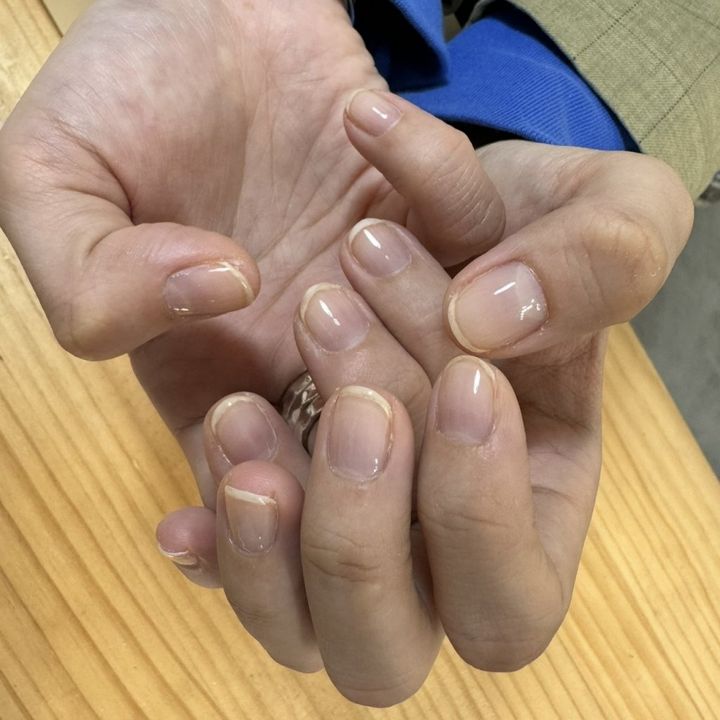 1年以上向き合った、爪のコンプレックスの話【FUDGENA SPECIALIST：kinokoのボーイズスタイル vol.174】