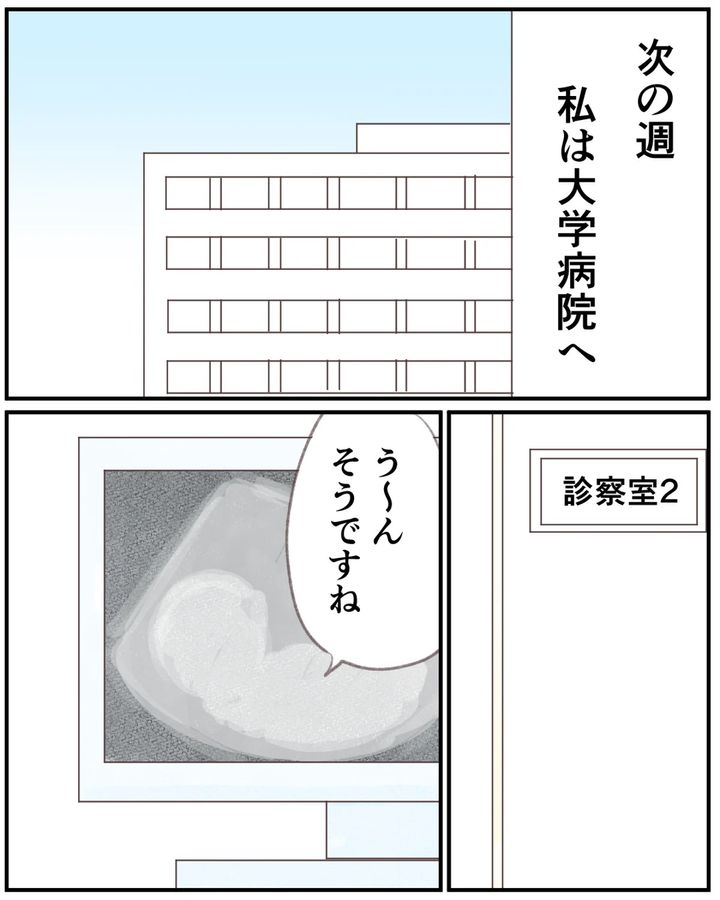 先天性食道閉鎖症／ようみん