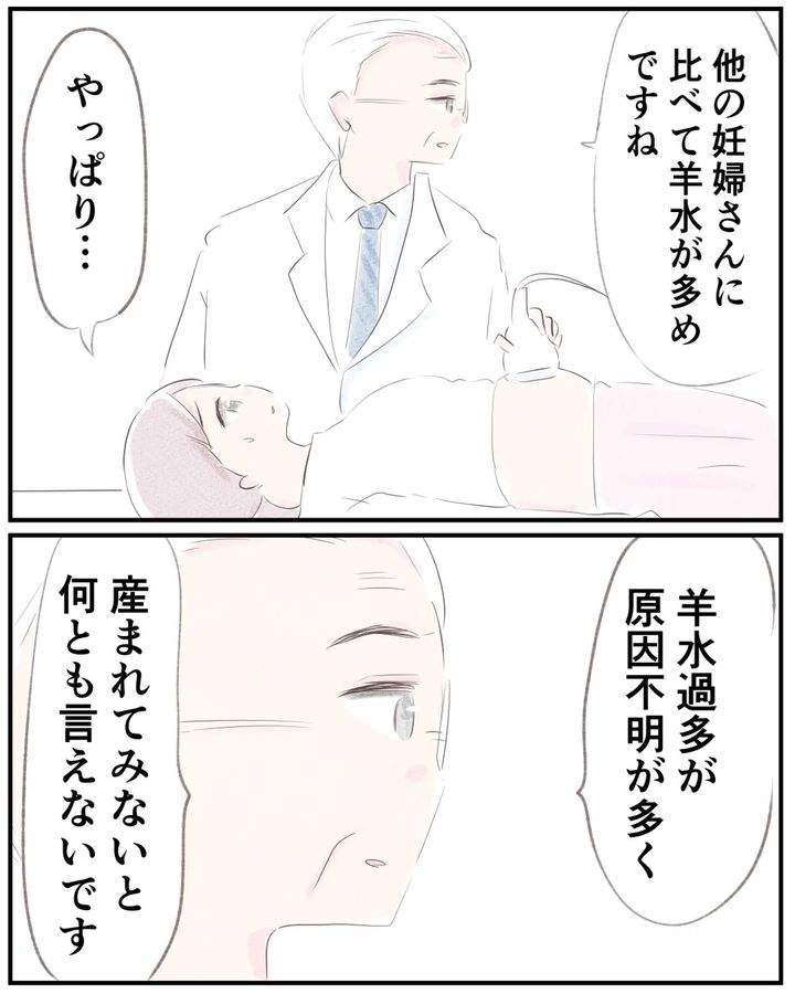 先天性食道閉鎖症／ようみん
