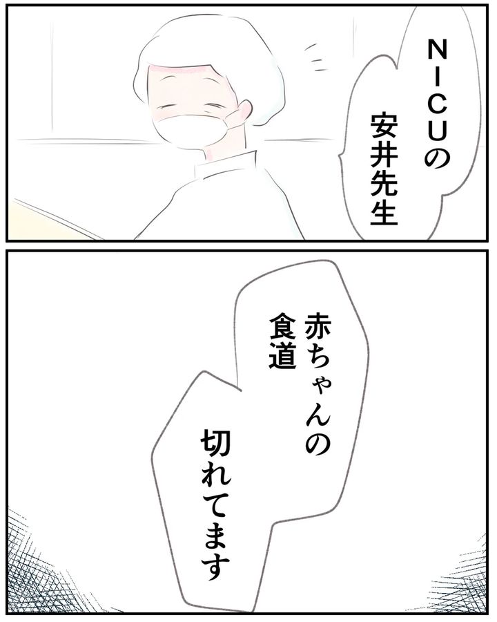先天性食道閉鎖症／ようみん
