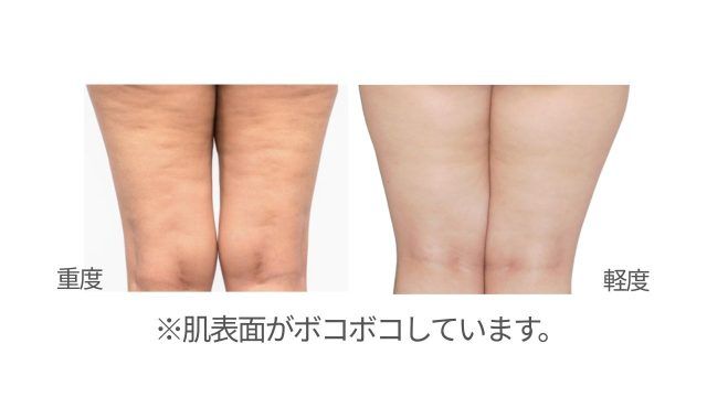 鏡で太ももの裏側をチェックする女性