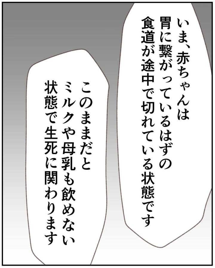 先天性食道閉鎖症／ようみん