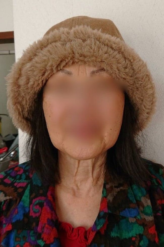 母の認知症介護日記／ワフウフ