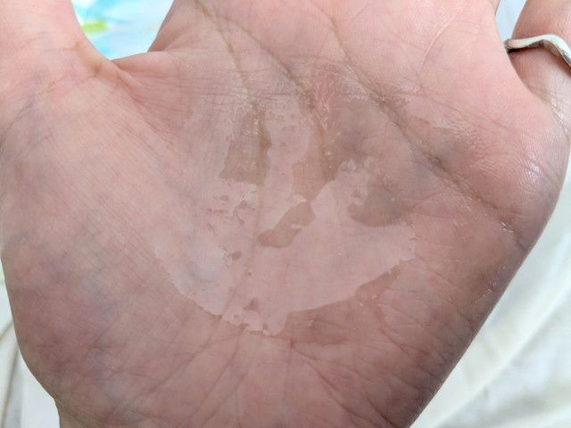 クナイプビオ オイル ローズを手のひらに出した様子