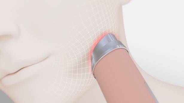 LIFTモード
