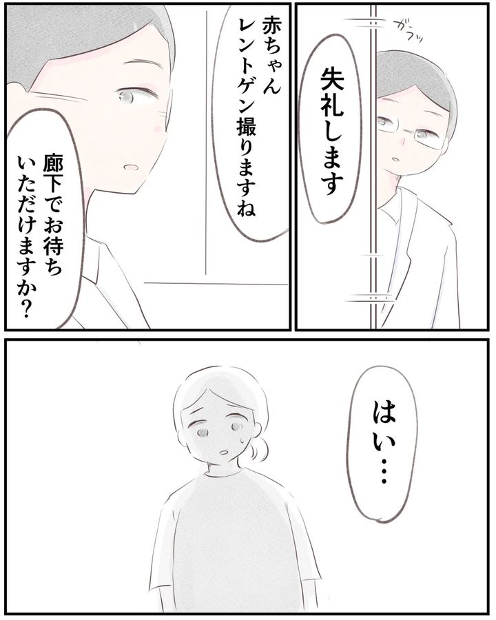先天性食道閉鎖症／ようみん
