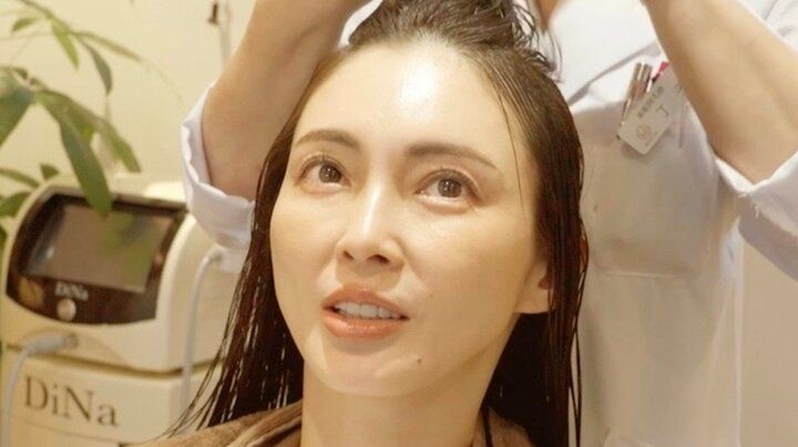 【写真・画像】「ピーリングしたら撮影日に顔の皮が…」 押切もえ（46）が失敗した美容語る 1枚目