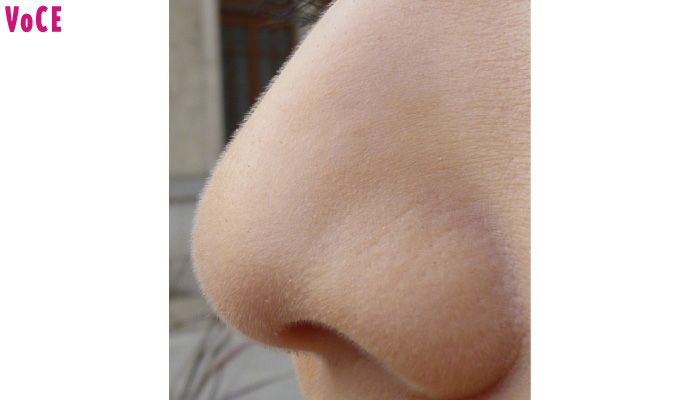 12歳からコメドを圧出している先生の鼻が美しすぎる！
