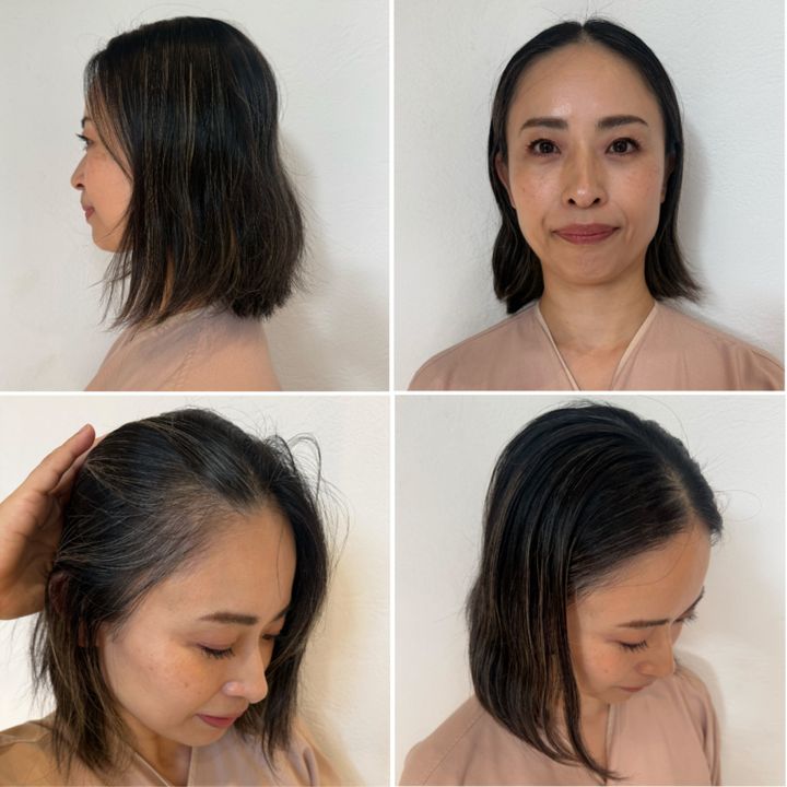 坂下眞美さんbefore