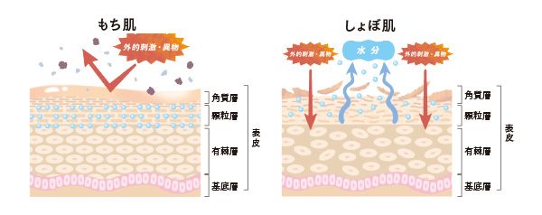 もち肌、しょぼ肌