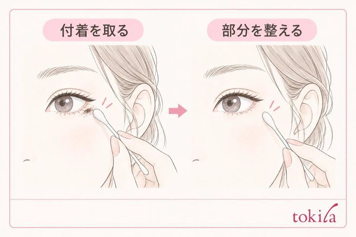 目尻の下へ移った色だけを綿棒で取り除く手順