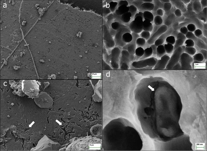 プラスチックを食べた酵素の「もう1つの顔」とは？