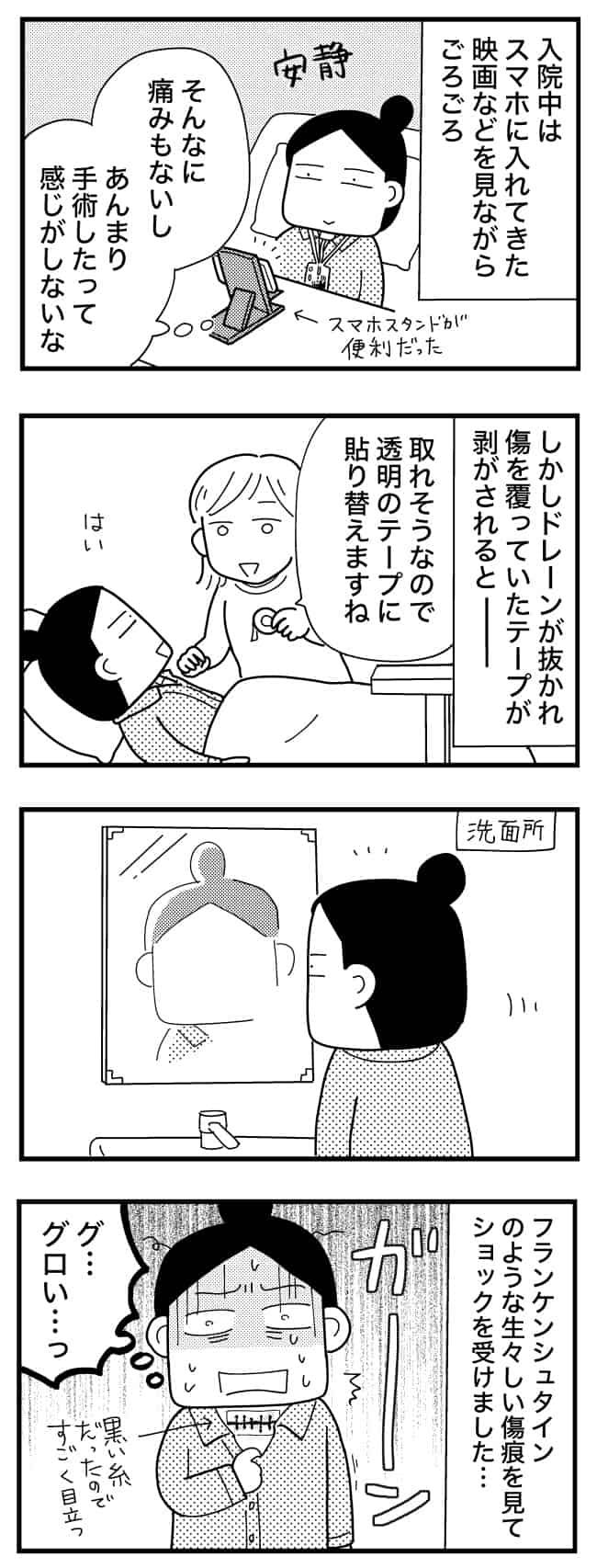 喉のしこりが甲状腺腫瘍だった話／和田フミ江