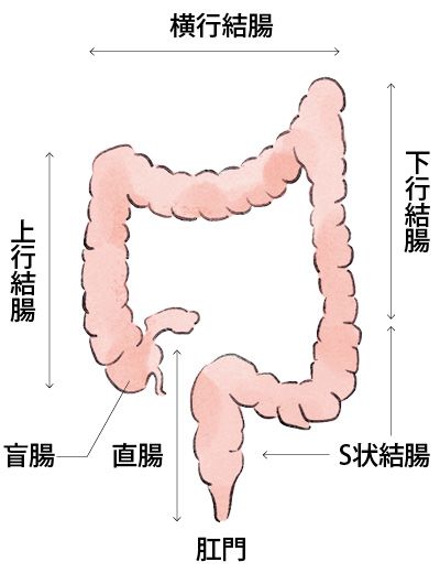 大腸がんは大きく2種類に分けられる
