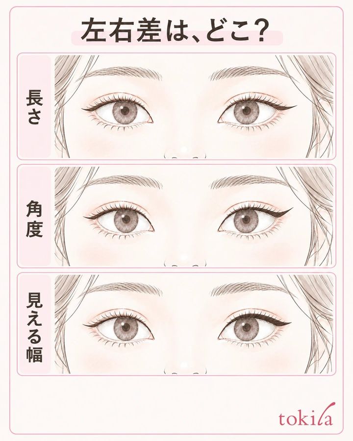 同じ両目でアイラインの長さ・角度・見える幅の差を一軸ずつ示した観察図