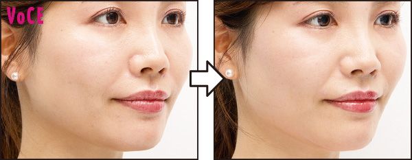 フェイスラインがシュッと！ もたつき感が和らいだ