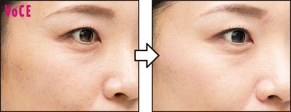 小ジワやキメの乱れが改善、なめらかで明るい印象に